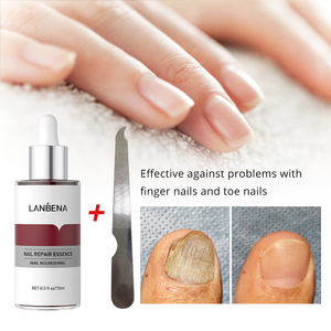 LANBENA Essence pour les ongles des pieds, gel réparateur pour les soins des ongles, onychomycose - Product Image 3