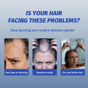 Suero Profesional para el Crecimiento <span class=keywords><strong>del</strong></span> Cabello con Péptidos de Cobre GHK-Cu AHK-Cu para la Caída <span class=keywords><strong>del</strong></span> Cabello y la Línea <span class=keywords><strong>del</strong></span> Cabello en Hombres y Mujeres, Tópico, el Mejor OEM - Product Image 2