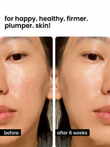 Suero cosmético coreano antiedad hidratante suavizante ácido hialurónico y suero de péptido de células madre de cobre - Product Image 4