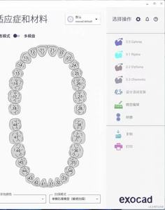Software Dental EXOCAD 3.3 Chemnitz para Laboratorio Dental, CAD Dental, Uso Vitalicio, Sin Cuota Anual, Uso Gratuito, EXOCAD 3.2 3.1 3.0 - Product Image 3