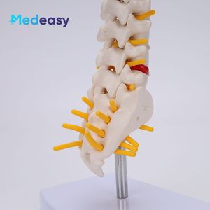 Modèle de colonne lombaire avec vertèbres caudales et mini simulateur de colonne lombaire - Product Image 5