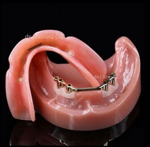 उच्च गुणवत्ता वाले व्यक्तिगत अनुकूलन पूर्ण-मुंह वाले डेबेंचर मुंह में बड़ी संख्या में लापता दांतों की मरम्मत - Product Image 4