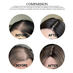 Extensiones <span class=keywords><strong>de</strong></span> <span class=keywords><strong>Cabello</strong></span> Humano Virgen Europeo con Base <span class=keywords><strong>de</strong></span> Seda, Clip, Kosher Judío, Medias Pelucas <span class=keywords><strong>para</strong></span> Mujeres con <span class=keywords><strong>Cabello</strong></span> Fino, Aspecto Natural del Cuero Cabelludo - Product Image 4