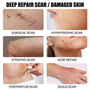 Crème Puissante et Efficace pour l'Élimination des Cicatrices d'Acné, Boutons et Vergetures, Gel Visage Raffermissant Effet Ventre Plat pour l'Élimination des Vergetures - Product Image 3