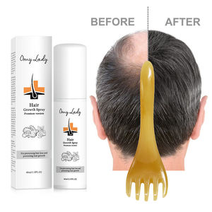 Ampule Omylady ผมร่วง,สเปรย์ปลูกผมขึ้นรูปเคราธรรมชาติน้ำมันสำหรับผมหัวล้าน - Product Image 3