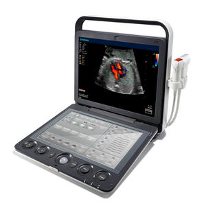 Ecógrafo Veterinario Profesional Sonoscape S9V para Exámenes Abdominales, Cardíacos y Vasculares Completos, Reutilizable - Product Image 1