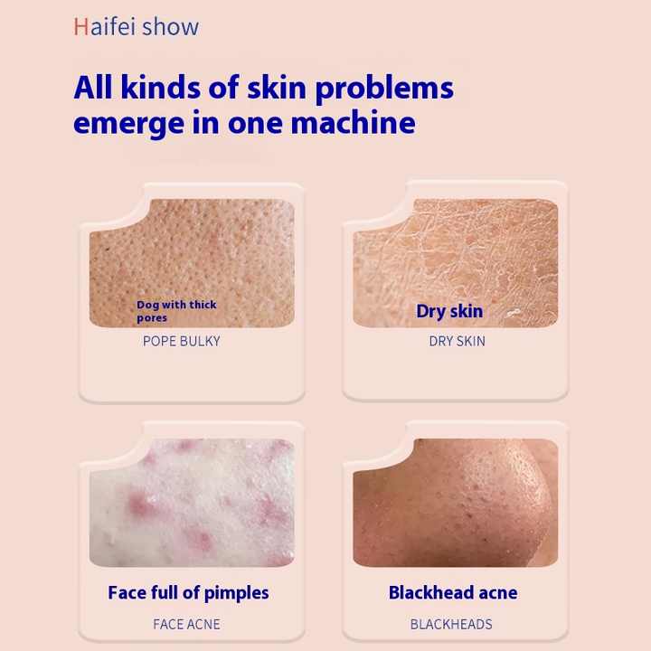 Comprehensive Skin Management Instrument 14 In1 Hydro Peeling Hydra ...