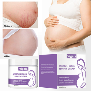 プライベートブランド マタニティスキンケア オーガニック ストレッチマーク除去クリーム - Product Image 4