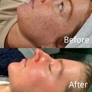 2025 OEM Bio-extrait liquide d'algues marines en microcristaux lyophilisés, Spicules, Collagène, Régénération, Anti-âge, Soin du visage - Product Image 5