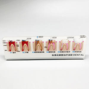 Model tampilan klinik gigi untuk menunjukkan penyakit periodalat-alat dan komunikasi antar gigi dalam renovasi mulut - Product Image 3