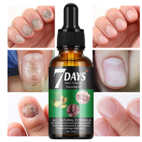 Sérum Anti-Mycose Ongles 7 Jours Marque Blanche Traitement et Réparation Mains Pieds Gel Anti-infectieux