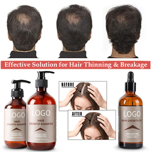 Juego <span class=keywords><strong>de</strong></span> lujo personalizado <span class=keywords><strong>para</strong></span> <span class=keywords><strong>el</strong></span> cuidado del crecimiento del cabello, champú y acondicionador <span class=keywords><strong>de</strong></span> <span class=keywords><strong>biotina</strong></span>, aceite <span class=keywords><strong>para</strong></span> <span class=keywords><strong>el</strong></span> crecimiento del cabello <span class=keywords><strong>de</strong></span> jengibre, engrosamiento anticaída - Product Image 2