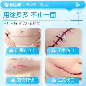 ผ้าพันแผลยืดหยุ่นแบบซิป Compromise Elastic Bandage Tb-2 ขนาด 40 มม. สำหรับลดแรงกดบริเวณแผล ช่วยสมานแผลหลังผ่าตัดโดยไม่ต้องเย็บ - Product Image 2