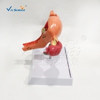 Modèle pathologique de maladie utérine grandeur nature en PVC avec endométriose et fibromes pour l'enseignement médical CE ISO ROHS CNAS