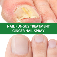Nouvel Arrivage 2025 Traitement Anti-Champignons des Ongles en Spray en 7 Jours Répare les Ongles Abîmés et les Cuticules Soins de la Peau 30ml Spray Ongles MOOYAM