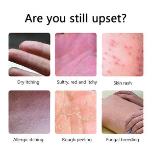 Krim gatal pelembap eksim, Krim Psoriasis anti pruritik cepat efektif, salep untuk Dermatitis dewasa - Product Image 4