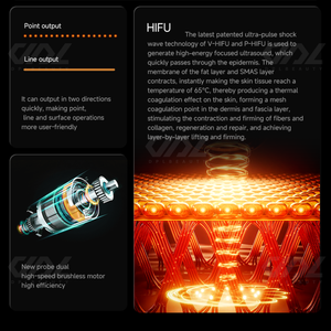 Dispositivo 3 in 1 EMS RF <span class=keywords><strong>Hifu</strong></span> Liposonics 360 Max 25D, Ultrasuoni Focalizzati ad Alta Intensità per Rassodamento della Pelle, Anti-Invecchiamento, Scrubber Cutaneo - Product Image 4