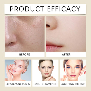 Tónico Facial de Houttuynia Cordata de Marca Blanca, 100 ml, Calmante, Alivia el Enrojecimiento, Controla la Grasa, Apto para Piel Sensible y Grasa, Uso Diario - Product Image 6