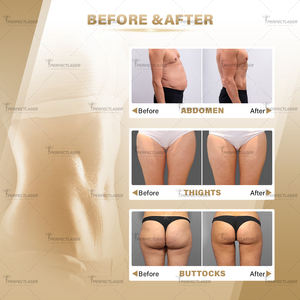 Máquina Profesional de Contorno Corporal, Quema de Grasa, Pérdida de Peso, Estimulación Muscular, 16 Tesla EMS <span class=keywords><strong>Neo</strong></span>, 5 Manijas, Dispositivo EMS en Venta - Product Image 5