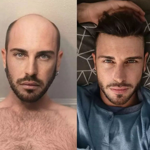 Parrucchino da uomo in <span class=keywords><strong>capelli</strong></span> indiani Remy lisci, con <span class=keywords><strong>base</strong></span> in pizzo e PU, lunghezza <span class=keywords><strong>6</strong></span> pollici, densità 100%-130%, contorno CC - Ingrosso Qingdao Modern - Product Image 2