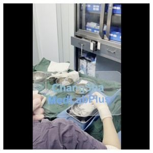 Micro Motor Choi Pen 2026 para Trasplante Capilar, Extracción de Unidades Foliculares e Implante, para Clínicas Profesionales - Product Image 6