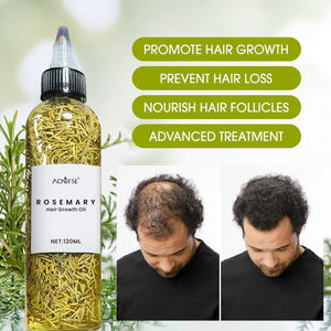 Aceite para el Crecimiento del Cabello Orgánico Natural al por Mayor, Cuidado del Cuero Cabelludo, Aceite de Romero para el Crecimiento del Cabello - Product Image 1