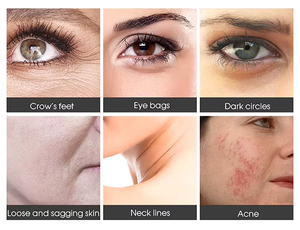 Dispositivo de Belleza Golden Eye, Herramienta de Infusión para el Cuidado de los Ojos, Máquina de Tratamiento Facial Portátil para Salón de Belleza - Product Image 6