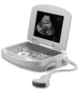 Schwangerschaft prüfung Ultraschall Medizinisches voll digitales Schwarzweiß-Ultraschall-Bildgebung system Günstige Ultraschall geräte Konvex