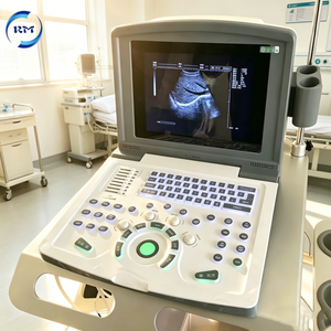 Máquina <span class=keywords><strong>de</strong></span> Ultrasonido Portátil Completamente Digital en Blanco y Negro para Uso Veterinario con Transductores <span class=keywords><strong>de</strong></span> Alta Calidad para Imágenes Médicas Veterinarias - Product Image 6
