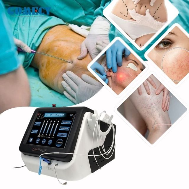 Professional Diode Laser 980nm 1470nm for Vascular Lesion Removal Nail Fungus Treatment Laser Lipolysis Physical Therapy 15W