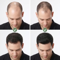 Sérum capillaire OEM à base de romarin, jojoba et ricin, traitement de repousse des cheveux, vegan, prévention de la perte de cheveux, huile essentielle pour la croissance des cheveux