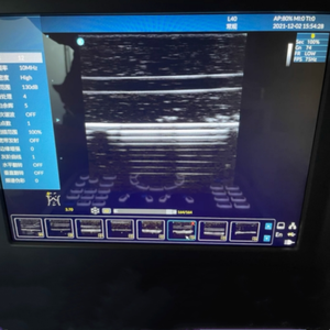 Module de formation à la ponction vasculaire guidée par échographie (PVG) + Module de formation aux interventions échographiques avec pompe de circulation (couleur chair) - Product Image 5