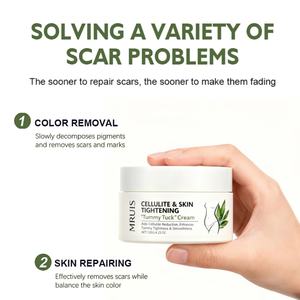 <span class=keywords><strong>Crema</strong></span> <span class=keywords><strong>Para</strong></span> eliminar estrías de 120G <span class=keywords><strong>para</strong></span> mujeres <span class=keywords><strong>embarazadas</strong></span>, reparación de la piel, cuidado de la piel, <span class=keywords><strong>crema</strong></span> <span class=keywords><strong>para</strong></span> eliminar estrías de abdominoplastia <span class=keywords><strong>para</strong></span> el cuerpo - Product Image 5