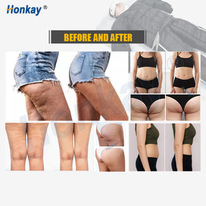 เครื่องกดประคบแบบ ODM ยอดนิยมสำหรับควบคุมหน้าจอ ช่วยกระชับสัดส่วน ลดไขมัน และระบายน้ำเหลือง เหมาะสำหรับใช้ในร้านเสริมสวยและสปา - Product Image 5