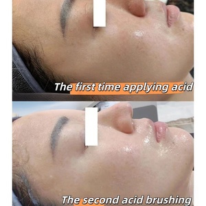 Suero Exfoliante Químico Facial con Ácido Glicólico, Láctico y <span class=keywords><strong>AHA</strong></span>/BHA, Solución Anti Poros, Aclarante Triple Ácido, Venta al Por Mayor OEM - Product Image 2