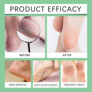 SOUTH MOON all'ingrosso leggero tacco idratante morbido fresco e facile da assorbire il piede zenzero nutriente Spray - Product Image 3