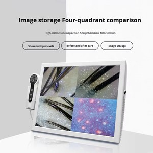 Nouveaux Scanners d'Analyse Capillaire Pratiques, Analyseur de Peau Numérique HD 15 Pouces pour Usage Domestique, <span class=keywords><strong>Scanner</strong></span> Haute Définition - Product Image 2