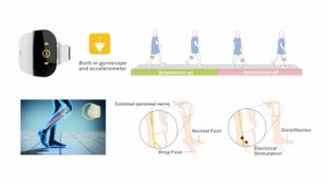 Peralatan rehabilitasi Stroke untuk kaki, peralatan Fes titik kaki XFT-2001E G4 canggih neurorehabiliasi - Product Image 3