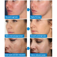 ZS personnalisé petites molécules ampoule d'acide hyaluronique hydratant en profondeur collagène Ha sérum lutte contre les ridules et les rides