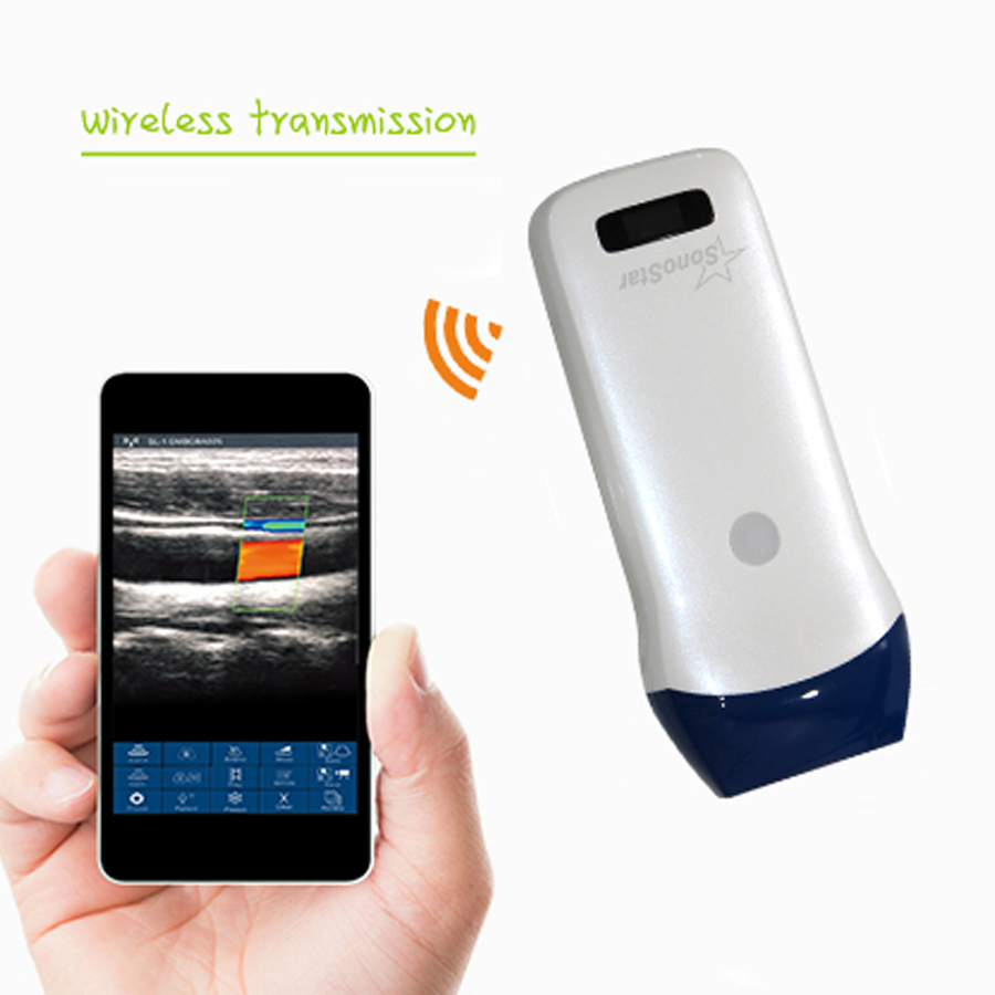 sonostar wireless ultrasound
