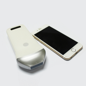 Machine à ultrasons linéaire sans fil B/W, site-rite, <span class=keywords><strong>échographie</strong></span> vasculaire, scanner à ultrasons linéaire, sonde linéaire portable - Product Image 5