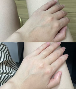 แคปซูลบำรุงมือและเท้า เครื่องมือความงามอัจฉริยะ แสงสีแดงและสีน้ำเงิน ช่วยฟื้นฟูคอลลาเจนและผิวขาวกระจ่างใส - Product Image 6