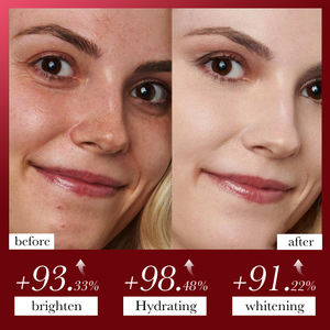 SADOER Inggris Masker Wajah & Tubuh mawar lintas batas grosir penghilang komedo Masker air mata pembersih - Product Image 5