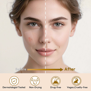 <strong>Hydrocollid</strong> Large Invisible Circle Pimple Patches for Full Face &amp; Body Waterproof Cruelty-Free Acne Treatment Custom Package CE - Product Image 4