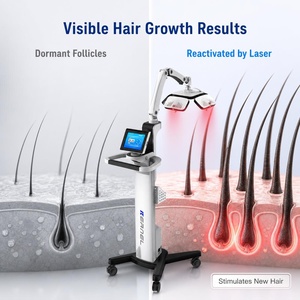 Kernel KN-8000A - Dispositivo Profesional de Rejuvenecimiento Capilar con Láser LLLT de 650 nm para la <span class=keywords><strong>Alopecia</strong></span> Androgenética y la <span class=keywords><strong>Alopecia</strong></span> <span class=keywords><strong>Areata</strong></span> - Product Image 2