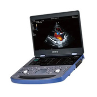 Échographe vétérinaire portable Mindray Vetus E7, scanner à ultrasons portable, appareil à ultrasons vétérinaire avec sonde à ultrasons