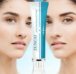 Creme Gel para Cicatrizes para Clareamento da Pele do Rosto e Reparação de Estrias Ingredientes Herbais 30ml para Todos os Tipos de Pele - Product Image 1