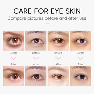 Masque pour les yeux en patchs à la caféine, hydratant, éclaircissant, <span class=keywords><strong>anti</strong></span>-rides, pour éliminer les <span class=keywords><strong>cernes</strong></span>, marque privée - Product Image 3