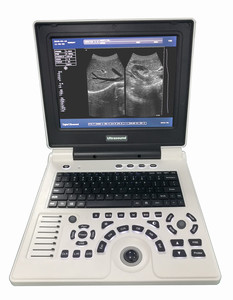Equipo de ultrasonido veterinario Máquina de ultrasonido Negro Blanco Precio barato Escáner de ultrasonido portátil AIB S30B 12 pulgadas 800x600 - Product Image 1
