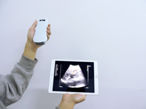 Konted MDR 3 in 1 senza fili convesso/lineare/cardioecografia a colori Doppler Wireless sonda ecografica kontted - Product Image 6